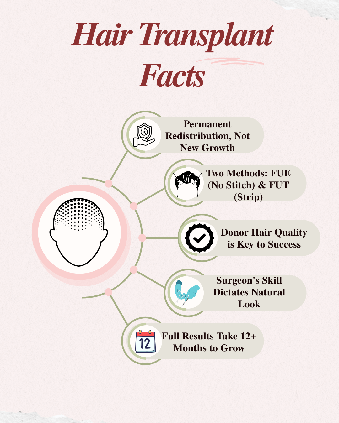 Infographic: Hair transplant facts
