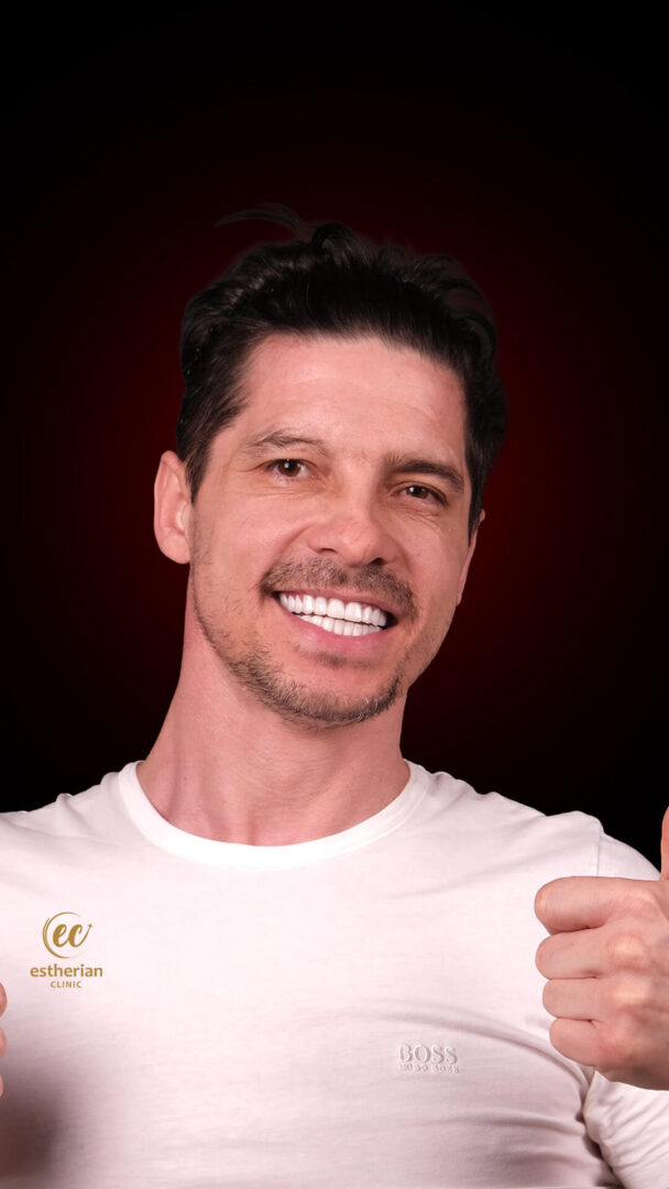 6 Implants, Bone Graft, 19 Teeth with Zirconium for the Hollywood Smile  (results by the Estherian Clinic)