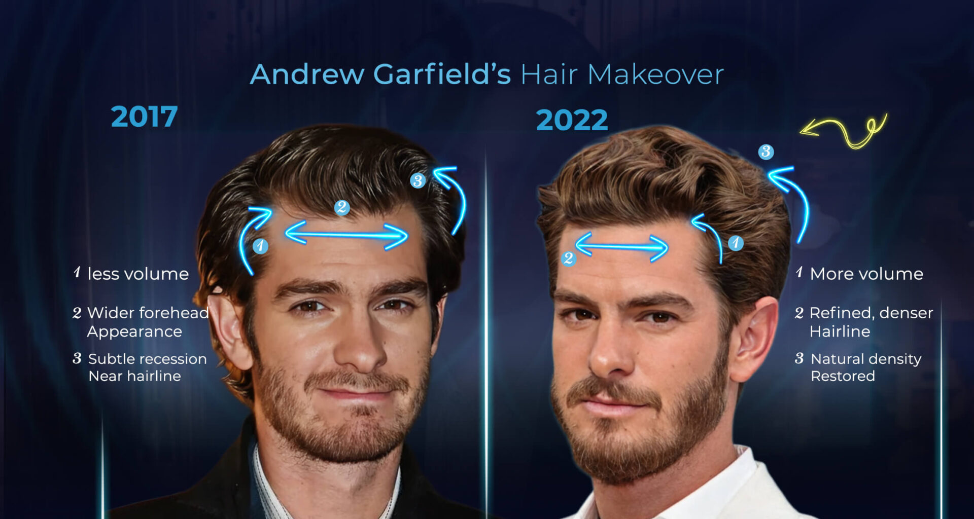 Andrew Garfield's Hair (2017 vs. 2022)