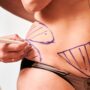 Body Contouring Surgery: Your Body, Refined