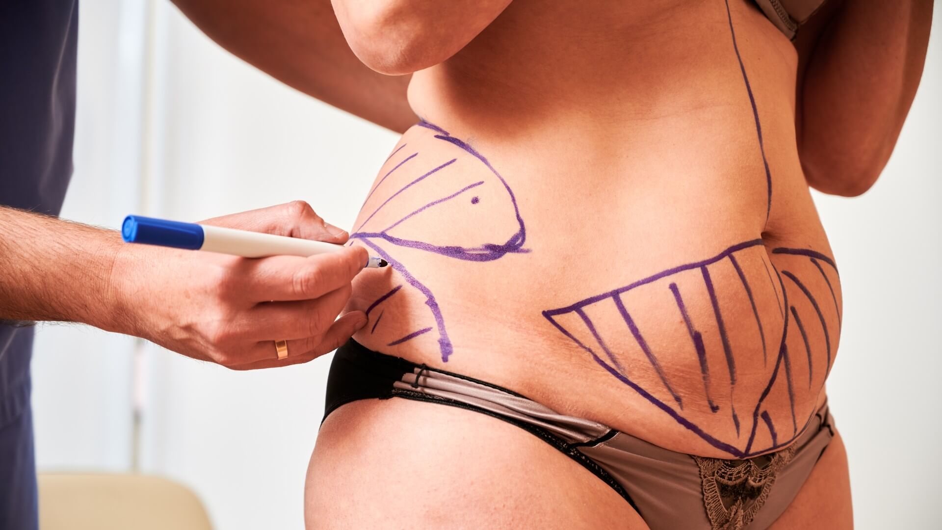 Body Contouring Surgery: Your Body, Refined