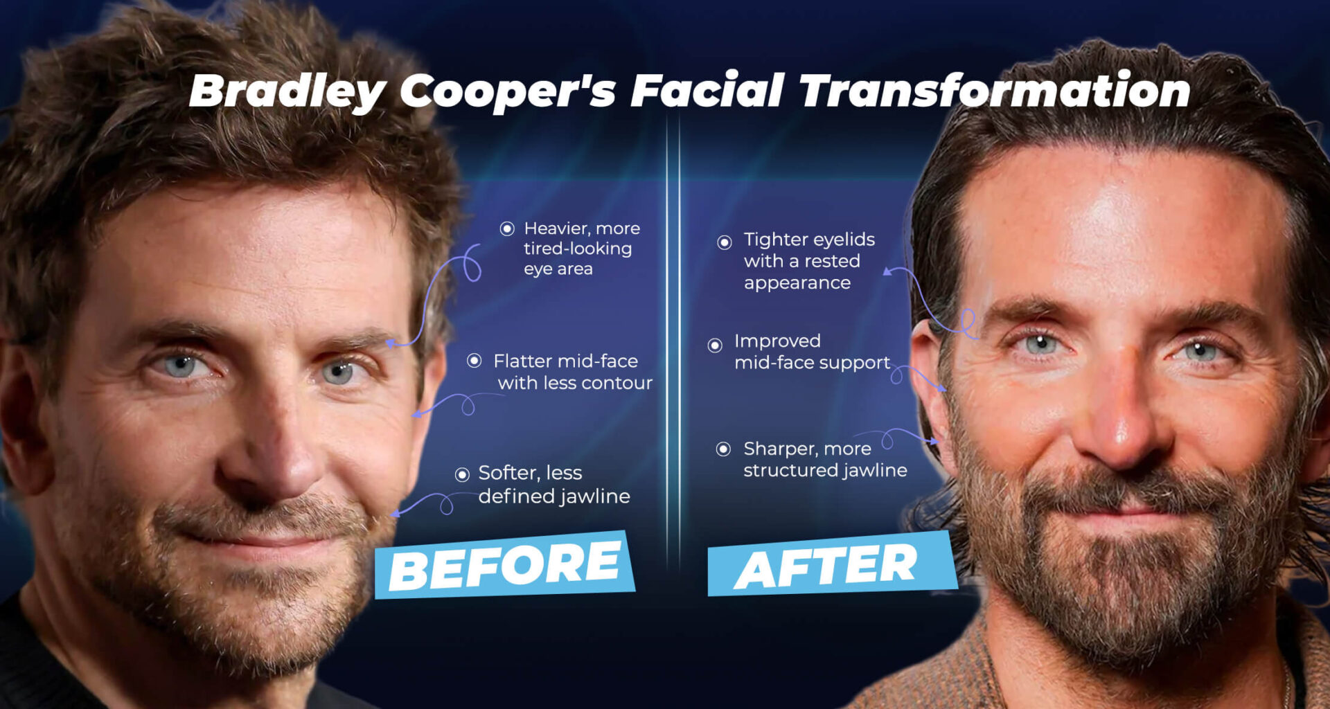 Infographic: Bradley-Cooper's-Facial-Transformation.