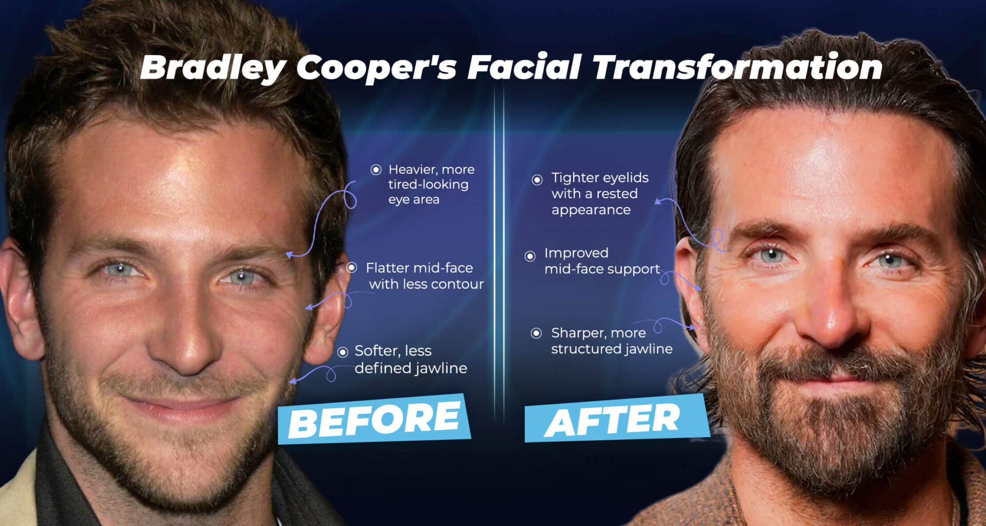 Bradley Cooper's Facial Transformation (before and after)