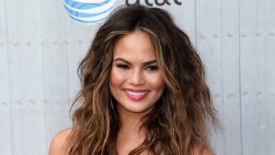 Chrissy Teigen’s Hairline-Lowering Surgery