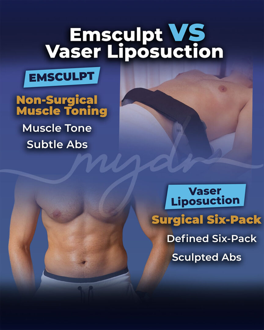 Emsculpt Vs. Vaser Liposuction Infographic