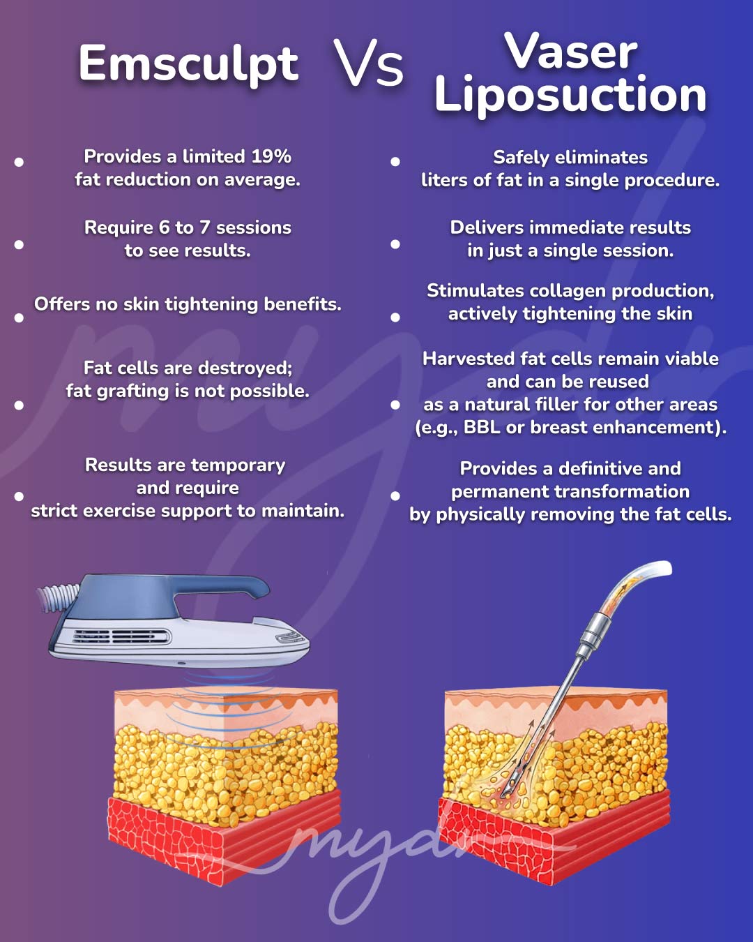 Emsculpt-VS-Vaser-Liposuction-Infographic