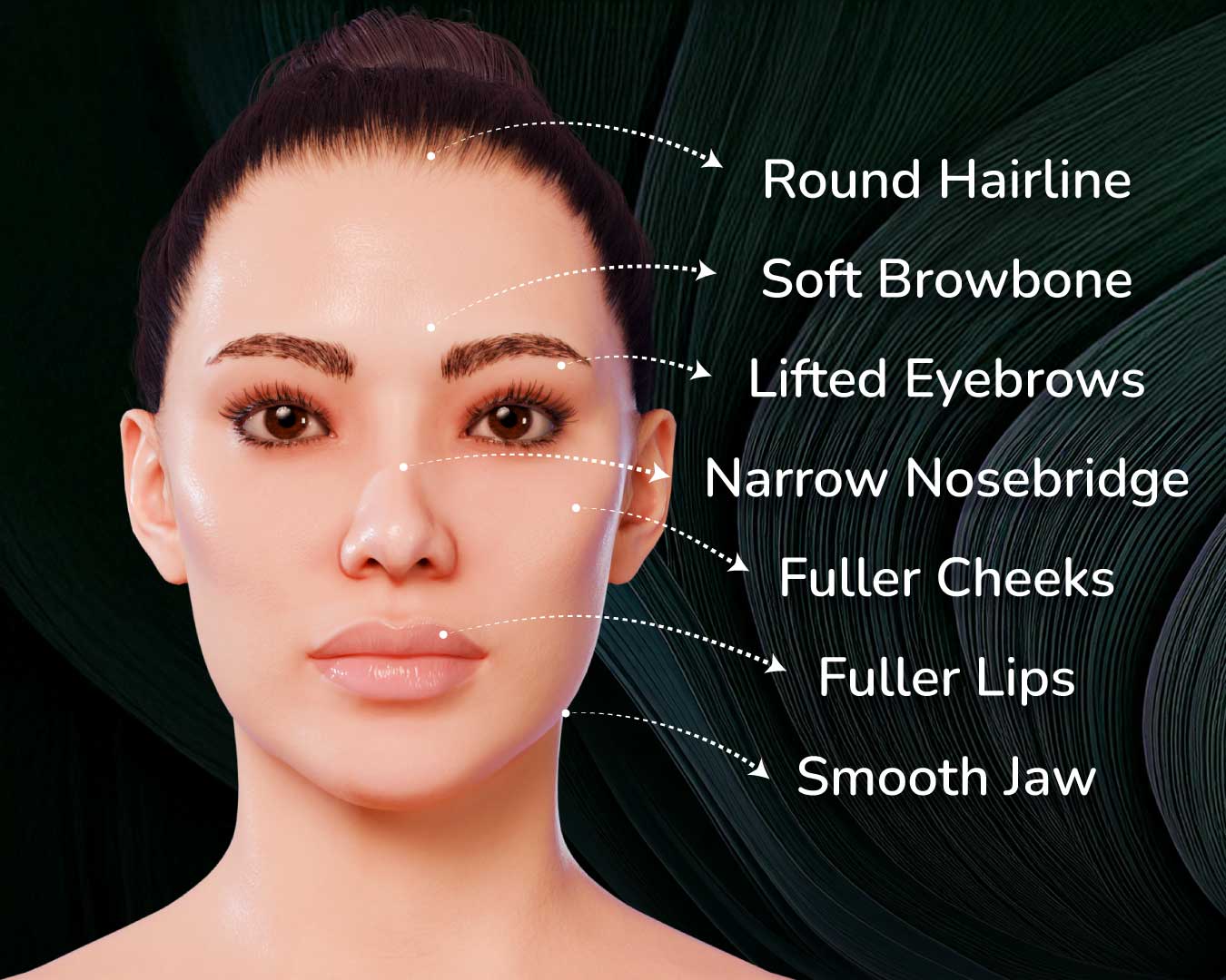 A Guide on Facial Feminization Surgery by Dr. Mehmet Yıldıran