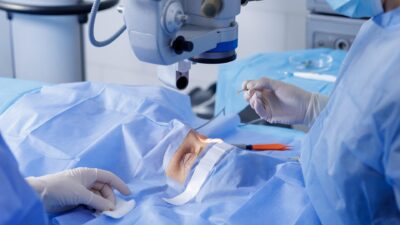 Fox Eye Surgery Recovery Day-by-Day