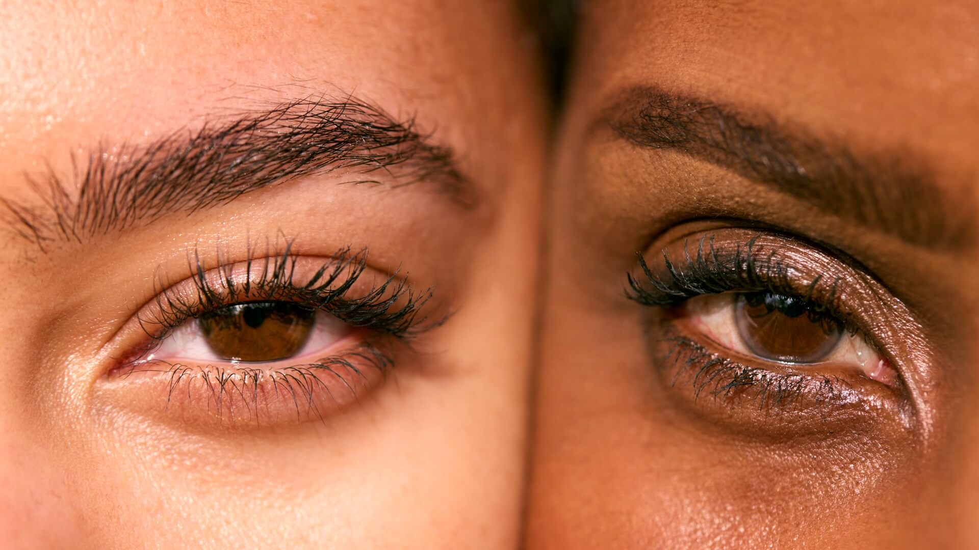 Is Fox Eye Surgery Right for You?