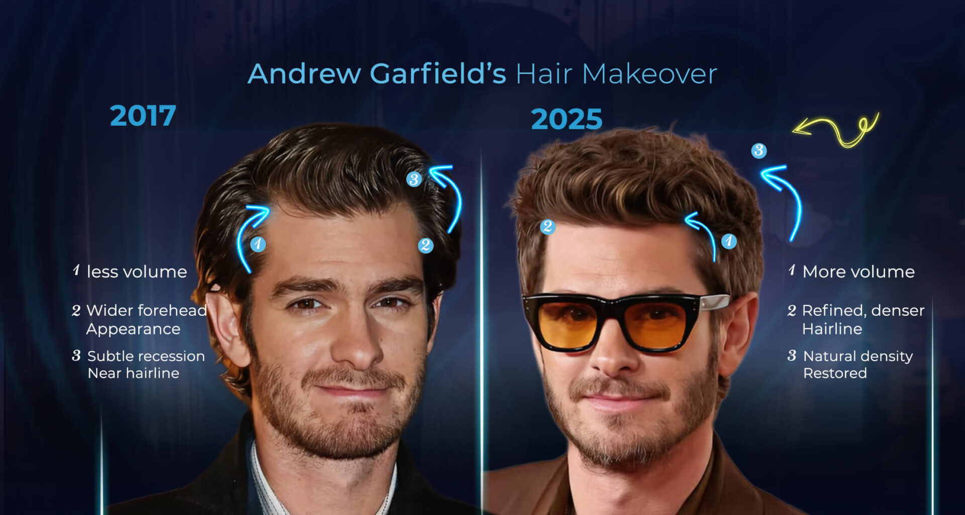 Andrew Garfield's hair transformation (2017 vs. 2025)