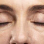 Eyelid Lift Without Surgery: Guide to Eye Rejuvenation